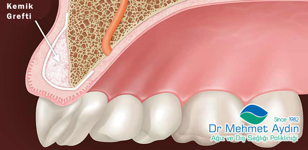 Dr Mehmet Aydın Ağız ve Diş Sağlığı Polikliniği Refaranslarımız