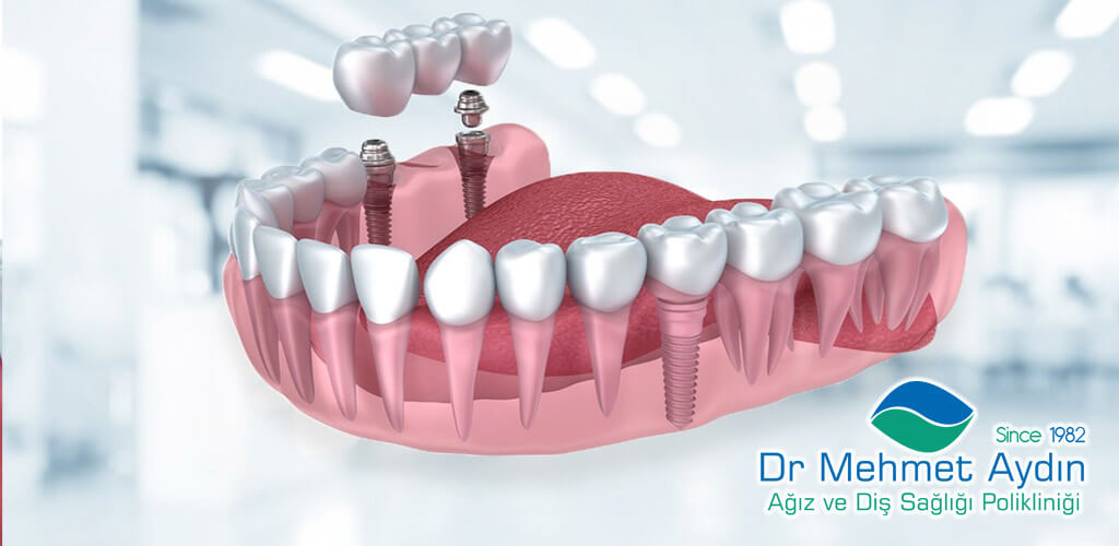 Dr Mehmet Aydın Ağız ve Diş Sağlığı Polikliniği Refaranslarımız