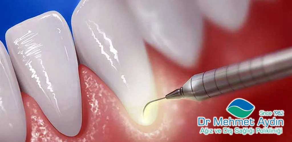 1. Sanayi Periodontoloji