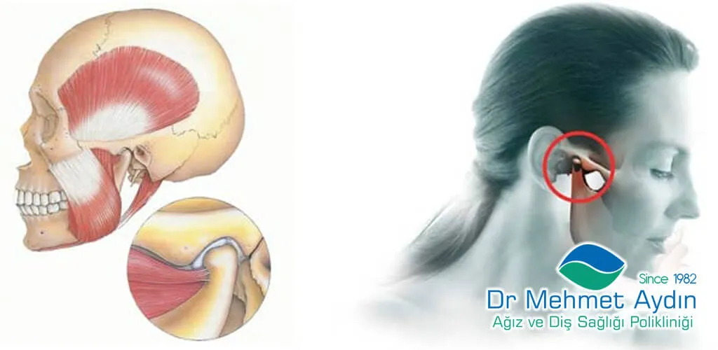  Temporomandibular Eklem